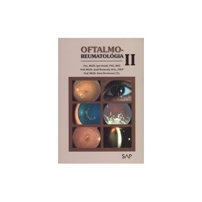 Oftalmo-reumatológia II.