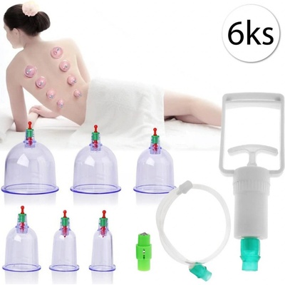 Medimas - Plastové vakuové masážní baňky - sada na baňkování 6 ks