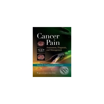 Cancer Pain: Assessment, Diagnosis, and Management - Dermot R. Fitzgibbon, John D. Loeser
