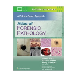 Atlas of Forensic Pathology: A Pattern Based Approach | Walter L. Kemp (ISBN: 9781975222505)