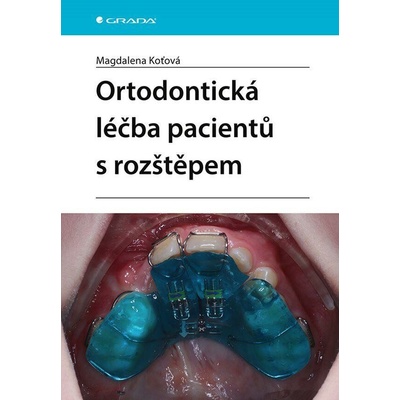 Ortodontická léčba pacientů s rozštěpem - Magdalena Koťová