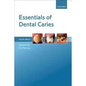 Essentials of Dental Caries | Edwina A. M. Kidd, Ole Fejerskov (ISBN: 9780198738268)