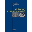 Záněty plic v intenzivní medicíně - Pavel Ševčík, Jana Skřičková, Vladimír Šrámek et al.