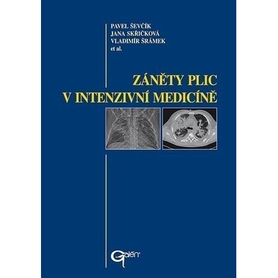 Záněty plic v intenzivní medicíně - Pavel Ševčík, Jana Skřičková, Vladimír Šrámek et al.