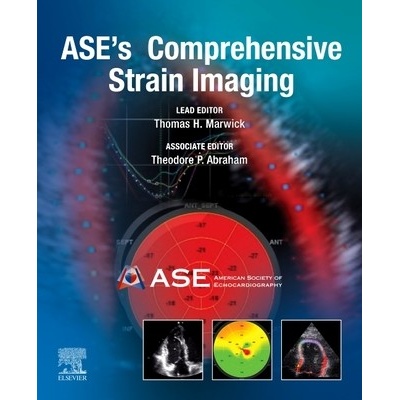Ases Comprehensive Strain Imaging Marwick