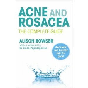 Acne and Rosacea | Alison Bowser (2010)