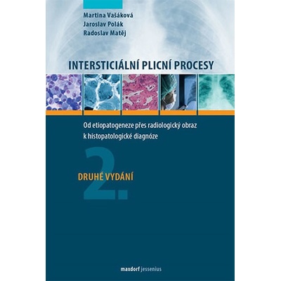 Intersticiální plicní procesy - Od etiopatogeneze přes radiologický obraz k histopatologické diagnóze - Vašáková Martina, Polák Jaroslav, Matěj Radoslav