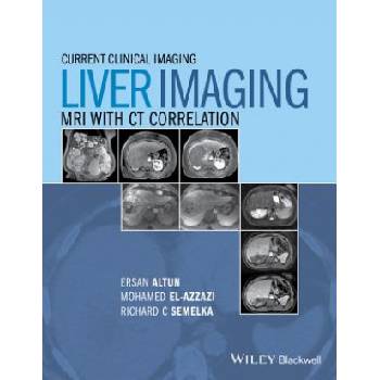 Liver Imaging - MRI with CT Correlation | Ersan Altun, Mohamed Elazzazi, Richard C. Semelka, Larissa Braga