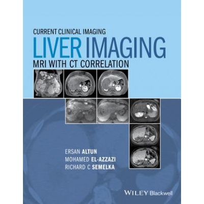 Liver Imaging - MRI with CT Correlation | Ersan Altun, Mohamed Elazzazi, Richard C. Semelka, Larissa Braga