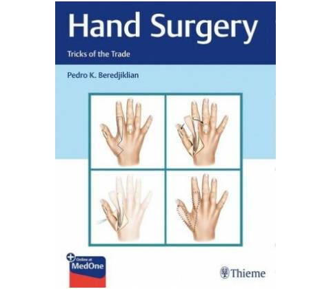 Hand Surgery