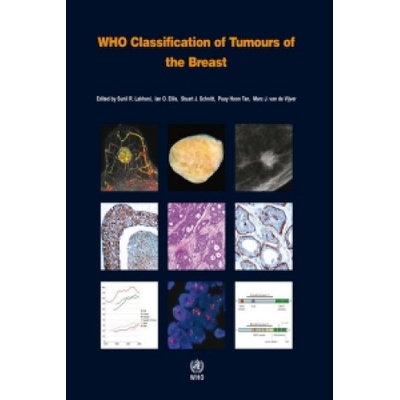 Who Classification of Tumours of the Breast - S.R. Lakhani
