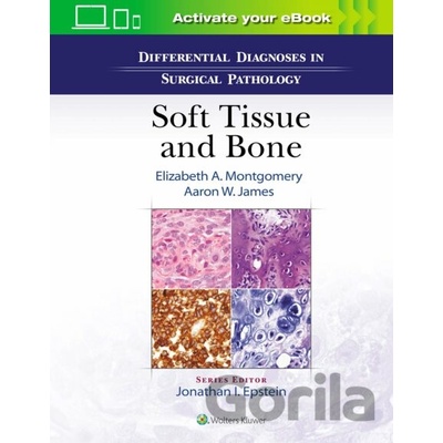 Differential Diagnoses in Surgical Pathology: Soft Tissue and Bone
