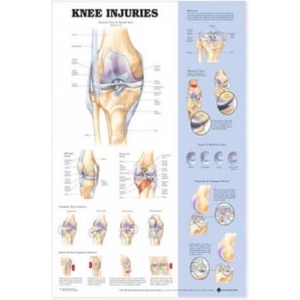 Knee Injuries Anatomical Chart | Anatomical Chart Company (ISBN: 9781587797569)