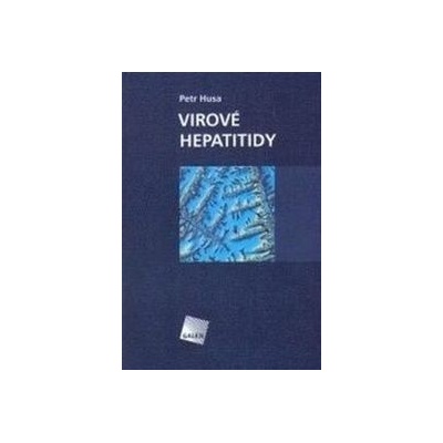 Virové hepatitidy - Petr Husa
