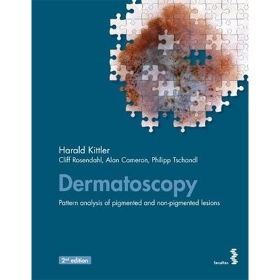 Dermatoscopy - Kittler, Harald
