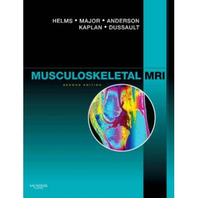Musculoskeletal MRI - Clyde A. Helms a kol.