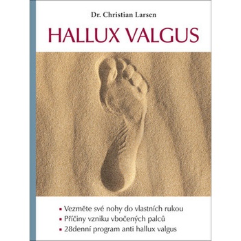 Hallux valgus