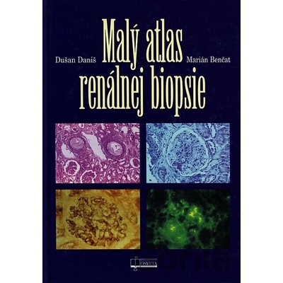 Malý atlas renálnej biopsie - Dušan Daniš, Marián Benčat