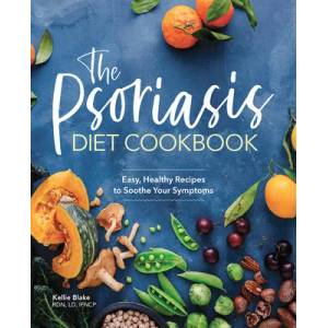 The Psoriasis Diet Cookbook: Easy, Healthy Recipes to Soothe Your Symptoms | Kellie Blake (ISBN: 9781646111541)