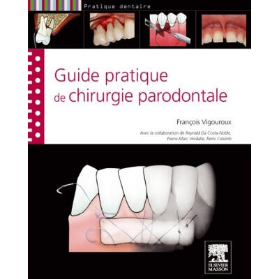 Guide pratique de chirurgie parodontale | François Vigouroux