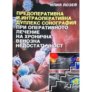 Предоперативна и интраоперативна дуплекс сонография при оперативното лечение на хронична венозна недостатъчност (ISBN: 9789548321174)