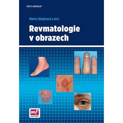 Revmatologie v obrazech - Marta Olejárová