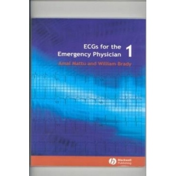 ECGs for the Emergency Physician 1 | Amal Mattu