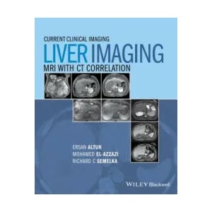 Liver Imaging - MRI with CT Correlation | Ersan Altun, Mohamed Elazzazi, Richard C. Semelka, Larissa Braga (2015)
