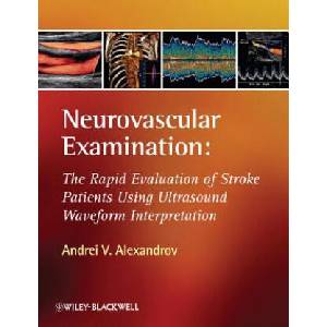 Neurovascular Examination - The Rapid Evaluation of Stroke Patients Using Ultrasound Waveform Interpretation (ISBN: 9781405185301)