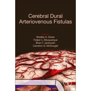 Cerebral Dural Arteriovenous Fistulas | Felipe C. Albuquerque, Brian T. Jankowitz (ISBN: 9780128195253)