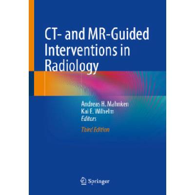 CT- and MR-Guided Interventions in Radiology