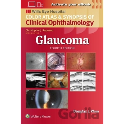 Glaucoma: Wills Eye Institute Atlas Series - Douglas J. Rhee