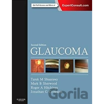 Glaucoma, 2nd Edition, 2-Volume Set