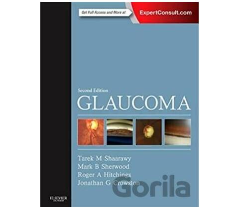 Glaucoma, 2nd Edition, 2-Volume Set