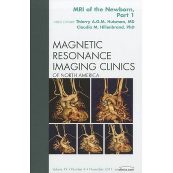 MRI of the Newborn, Part I, An Issue of Magnetic Resonance Imaging Clinics | Claudia Hillenbrand