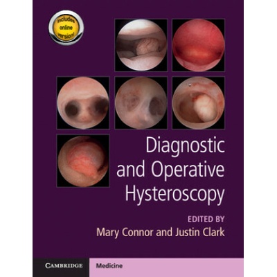 Diagnostic and Operative Hysteroscopy Justin Clark,Stephen Burrell