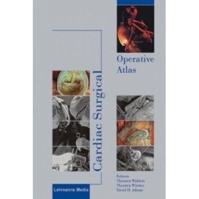 Cardiac Surgical Operative Atlas (Thorsten Wahlers,Thorsten Wittwer,David H. Adams)(Pevná)