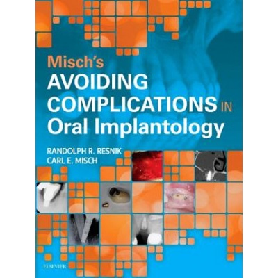 Misch's Avoiding Complications in Oral Implantology Misch Carl E.Pevná vazba