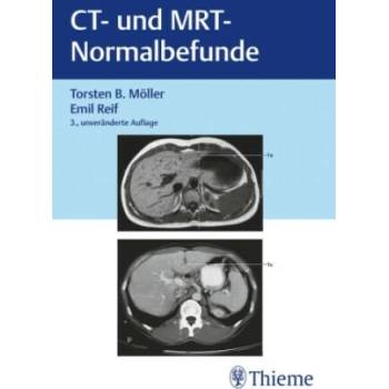 Image 1 of CT und MRT Normalbefunde | Emil Reif
