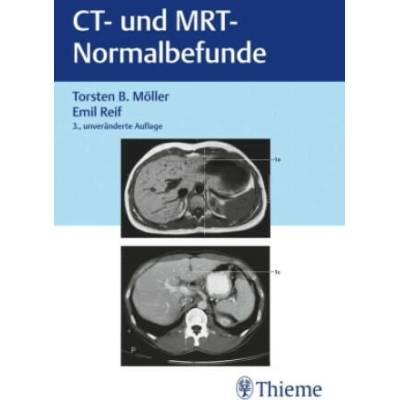 CT und MRT Normalbefunde | Emil Reif