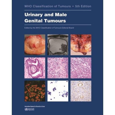 Urinary and Male Genital Tumours