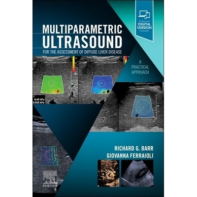 Multiparametric Ultrasound for the Assessment of Diffuse Liver Disease: A Practical Approach Barr Richard G.