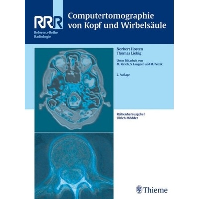 Computertomographie von Kopf und Wirbelsäule