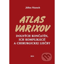 Atlas varixov dolných končatín, ich komplikácií a chirurgickej liečby Július Mazuch