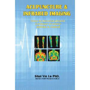 Acupuncture and Infrared Imaging | Shui Yin Lo (ISBN: 9781647849610)