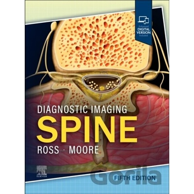 Diagnostic Imaging Spine - Jeffrey S. Ross