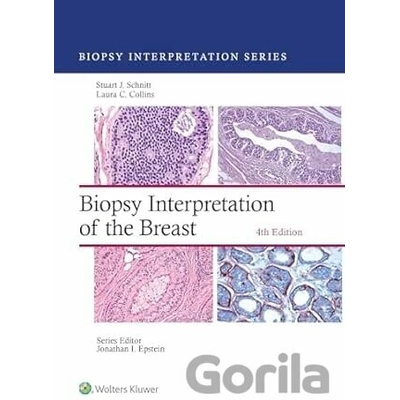 Biopsy Interpretation of the Breast: Print + eBook with Multimedia - Stuart J Schnitt, Laura C. Collins