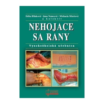Nehojace sa rany