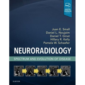 Neuroradiology: Spectrum and Evolution of Disease | Juan Small, Daniel Noujaim, Daniel Thomas Ginat, Kelly, Hillary R, MD, Schaefer, Pamela W, MD