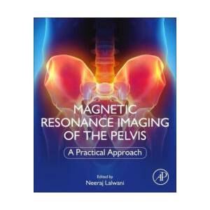 Magnetic Resonance Imaging of The Pelvis | Neeraj Lalwani (ISBN: 9780323898546)